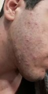 20180321_091111.jpg