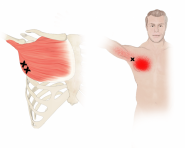 pectoralis-major-TP-3.png