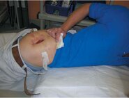 PRF_030113_FIG1.jpg