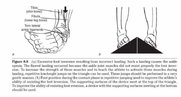 ankle_sprain.jpg