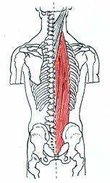 erector_spinae1331182090118.jpg