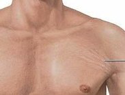 stretch-marks-bodybuilding.jpg