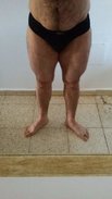 פרונט לגס 2.jpg